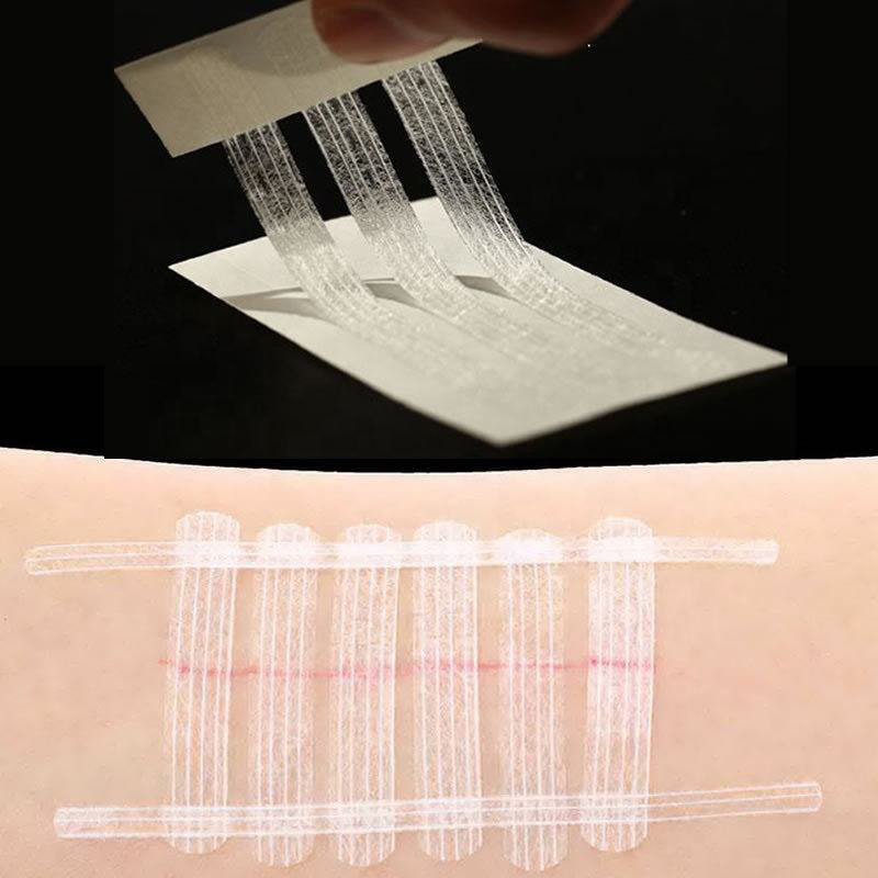 Steriler, selbstklebender Wundverschlussstreifen zum Einmalgebrauch